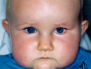 patient photo